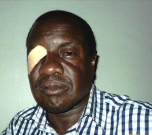 FREDERICK KIWANUKA AFTER BEING ASSAULTED IN 2014